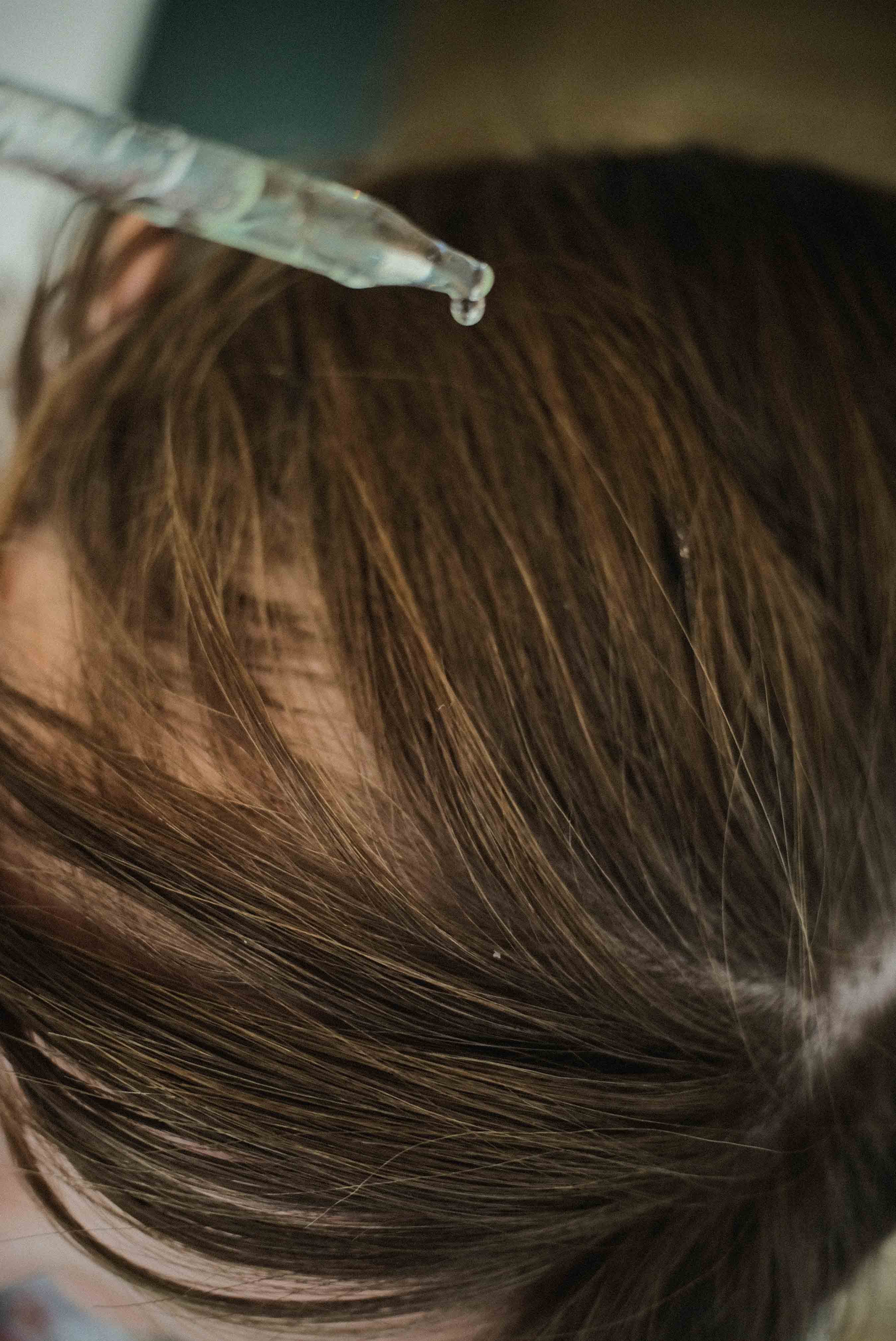 Hair growth oil being dropped onto scalp. Best organic serum for hair loss. Phalate free. paraben free